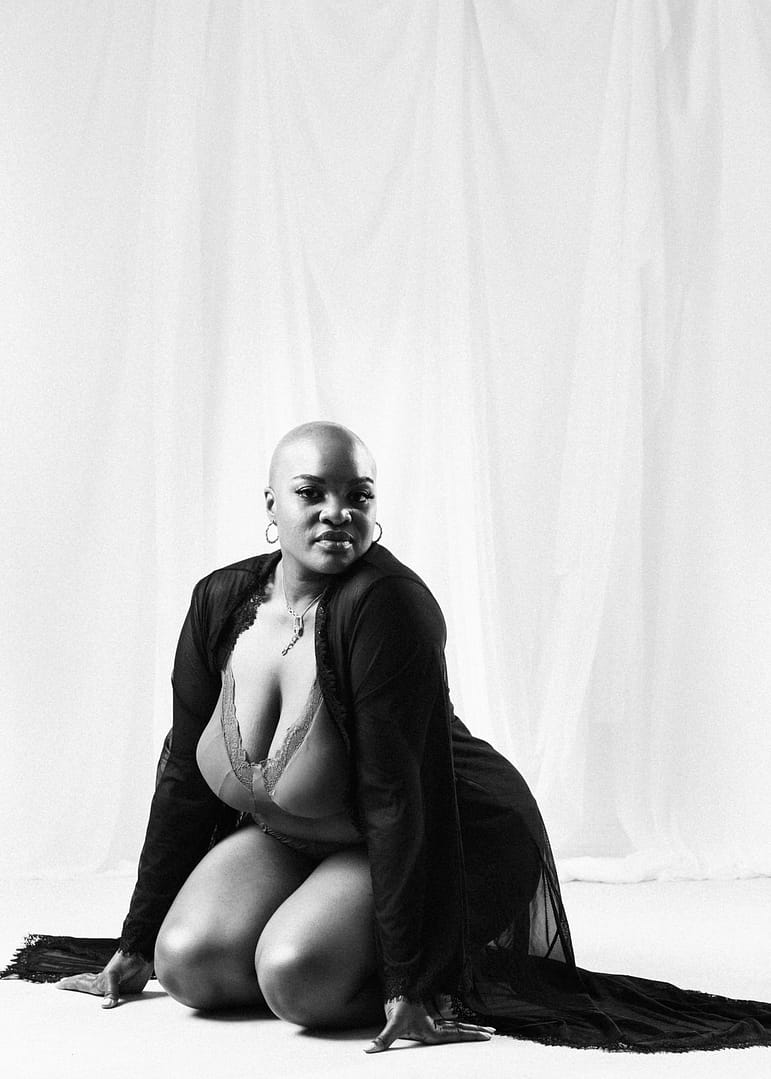 Embracing Alopecia: Vancouver Boudoir Photographer